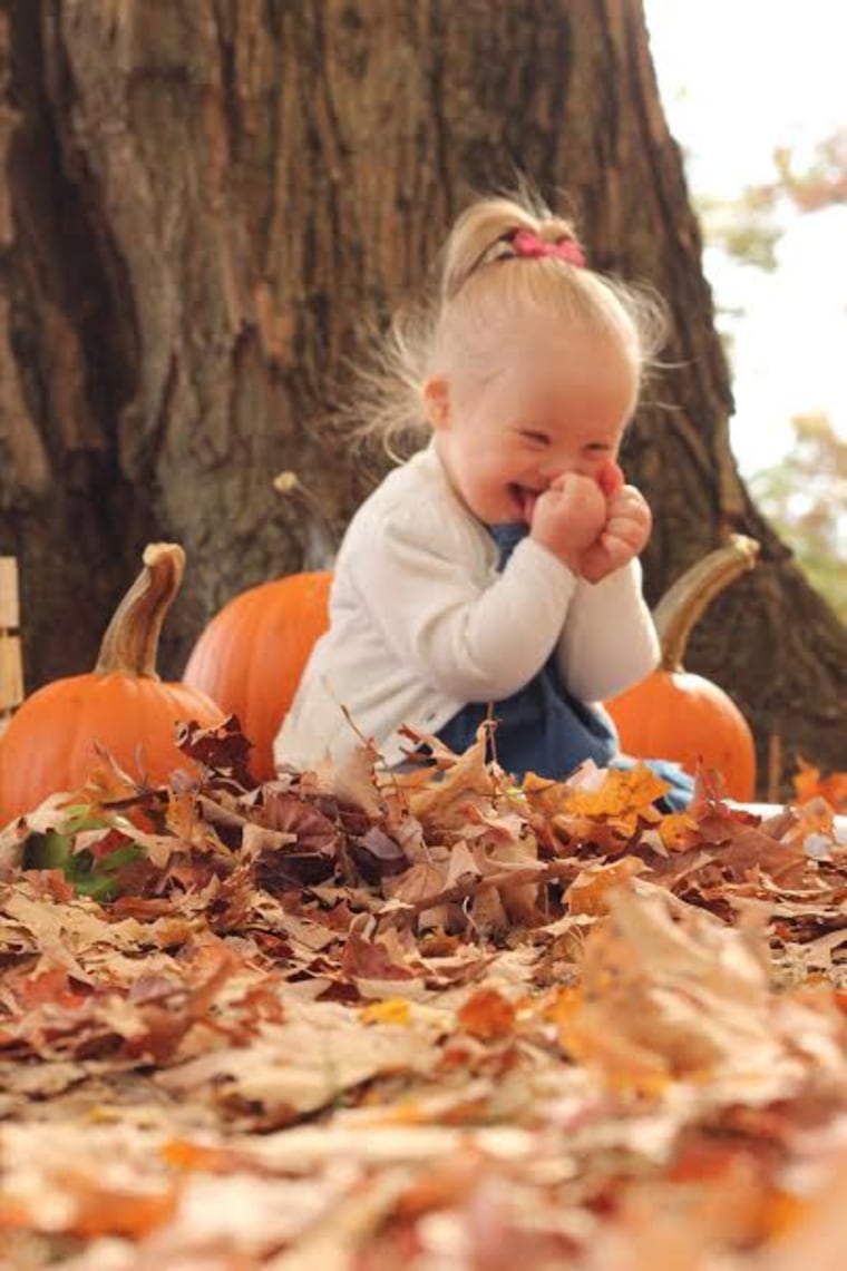 Photographer Laura Kilgus captured children with Down syndrome in a photo series