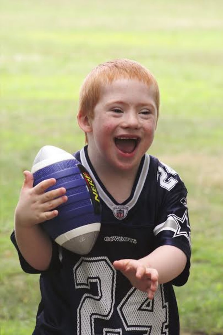 Photographer Laura Kilgus captured children with Down syndrome in a photo series