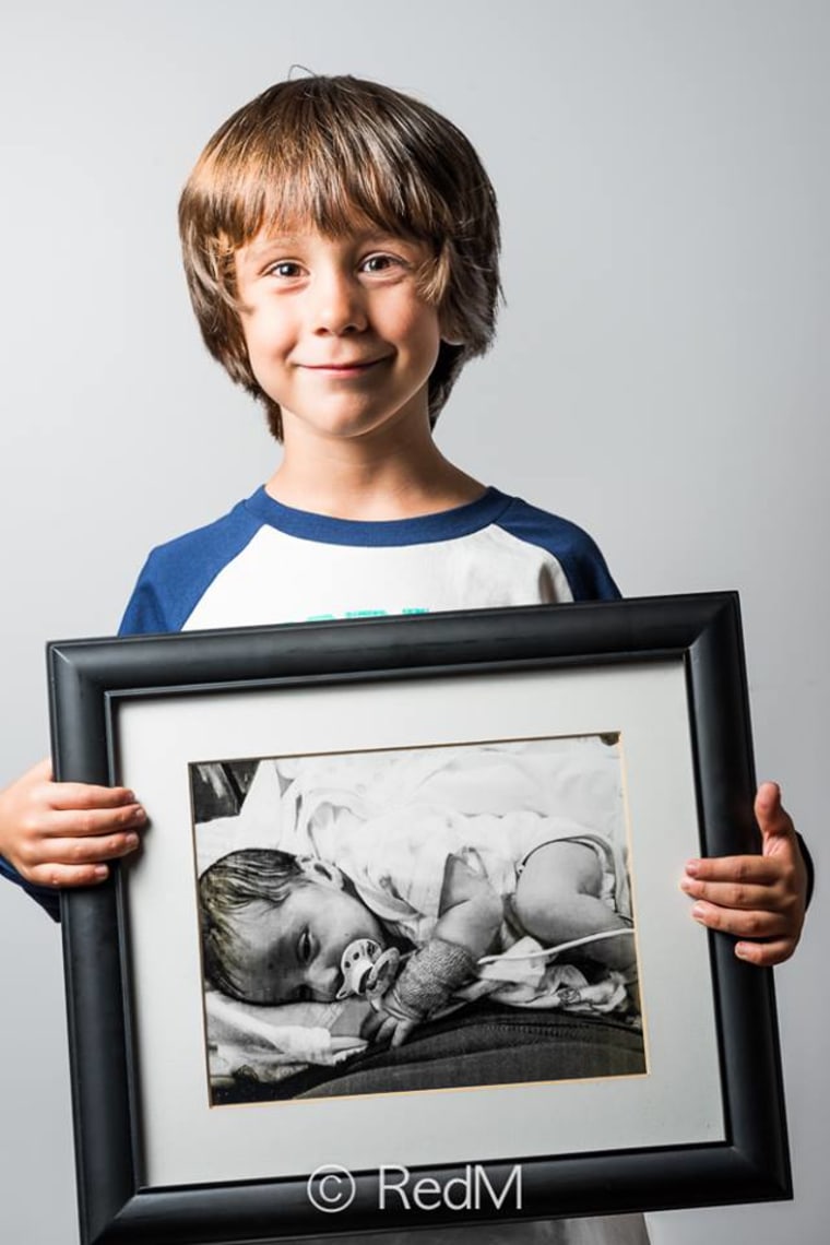 Red Methot portrait shows that premature babies can grow up to be happy and healthy children