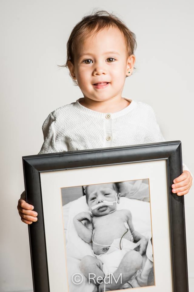 Red Methot photographic Facebook series shows premature babies as thriving children