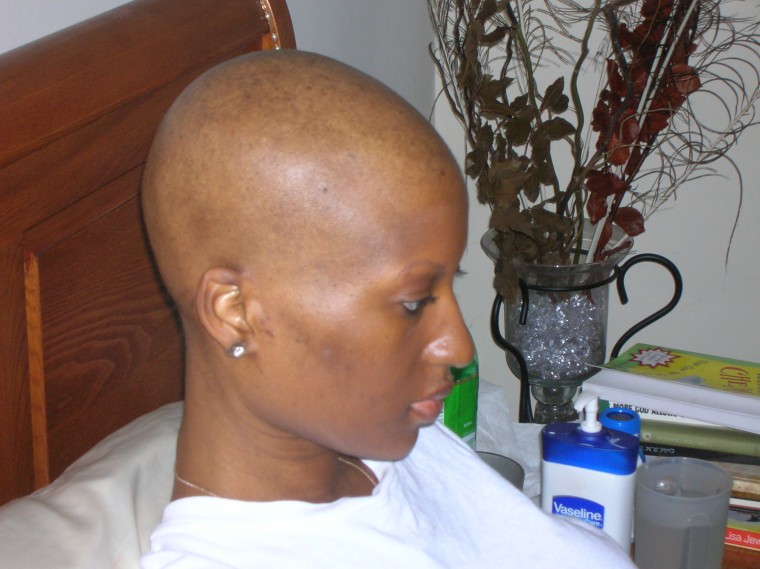 Maimah Karmo lost her hair during chemotherapy.