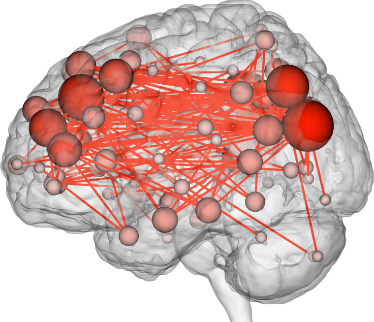 This image shows the functional connections in the brain that tend to be most discriminating of individuals. Many of them are between the frontal and parietal lobes, which are involved in complex cognitive tasks.

