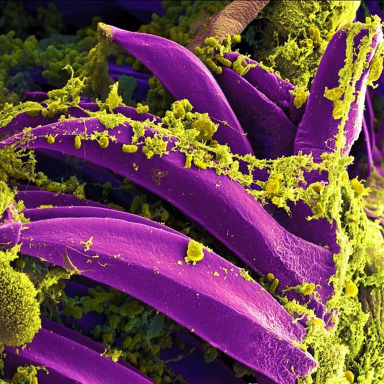 Image: Plague causing Yersinia pestis bacteria