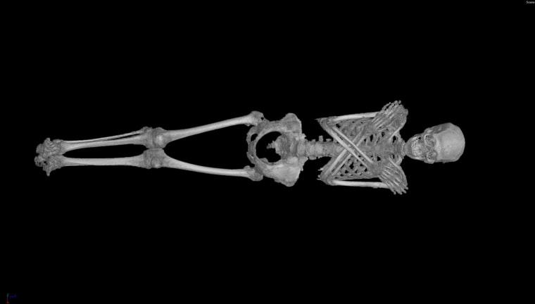 Photo: CT scan shows the skeleton of intact mummy from Roman-era Egypt (30 BC –AD 395) known as the Gilded Lady.