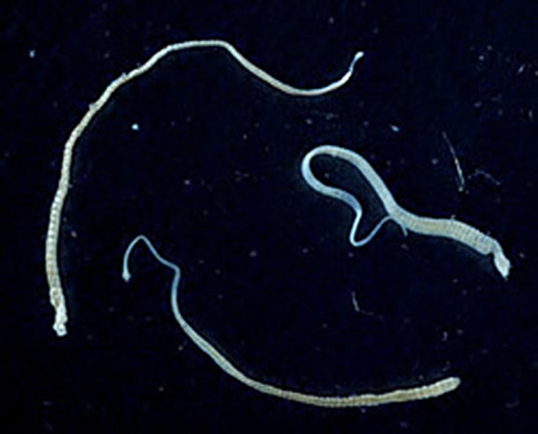 Three adult specimens of the tapeworm Hymenolepis nana. 