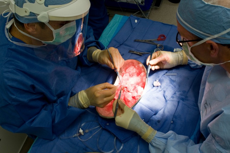 Image: Doctors work on a kidney recently removed from a donor