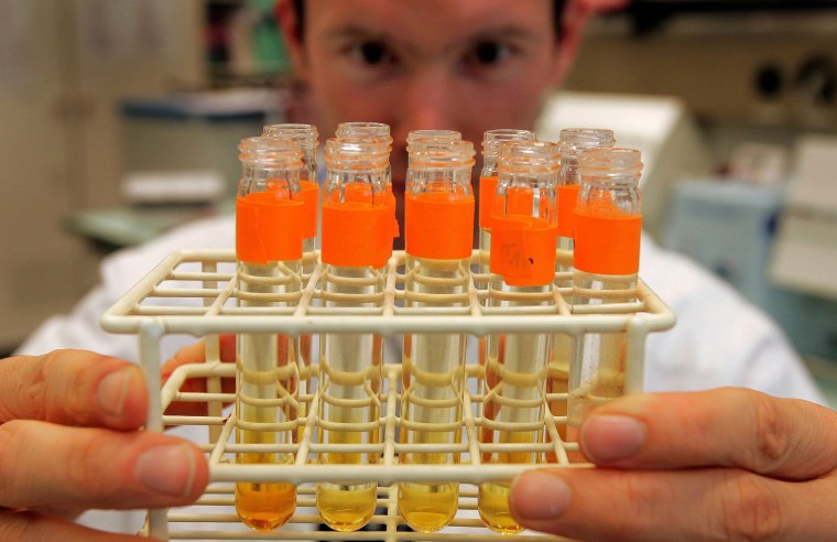 Image: A file photo shows urine samples prepared for testing