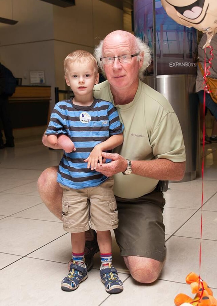 Adopted grandson and new grandfather bond over missing right hands