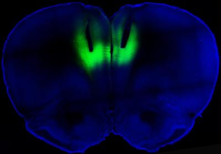 Laser light delivered through fiberoptic cables directed at the prefrontal cortex (shown here by their tracks) is used to modulate firing activity of neurons expressing light-sensitive molecules (shown in green fluorescence) to regulate cocaine-seeking behavior in rats.
