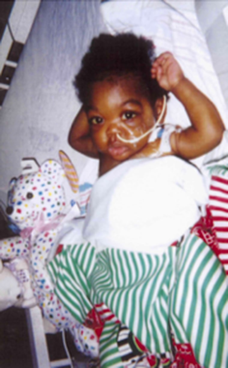 Ashli Taylor suffered from congenital cirrhosis of the liver when she was a year old, necessitating a liver transplant.