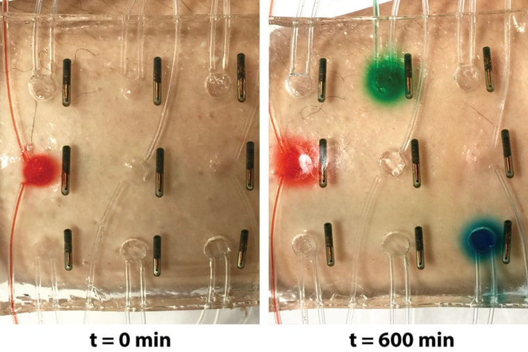 Image: a stretchy bandage that can deliver drugs and light up