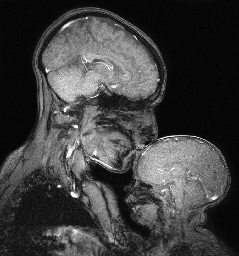 MRI of a woman and her baby