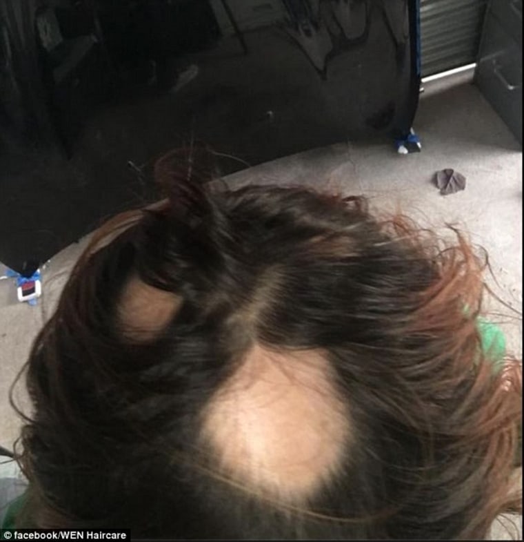 Class-Action Suit: Women have complained about the alleged effects of Wen by sharing photos of their bald spots on social media. The company is being sued by 200 consumers in a class action lawsuit that claims Wen made their hair fall out and damaged their scalps.