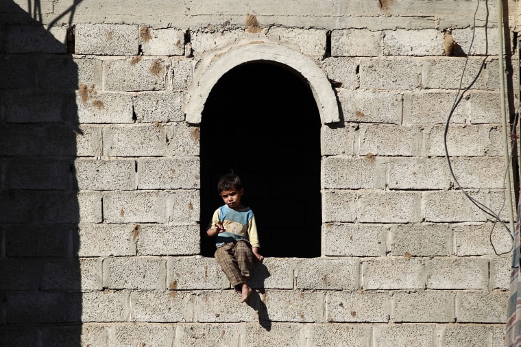 Image: TOPSHOT-YEMEN-CONFLICT-CHILDREN