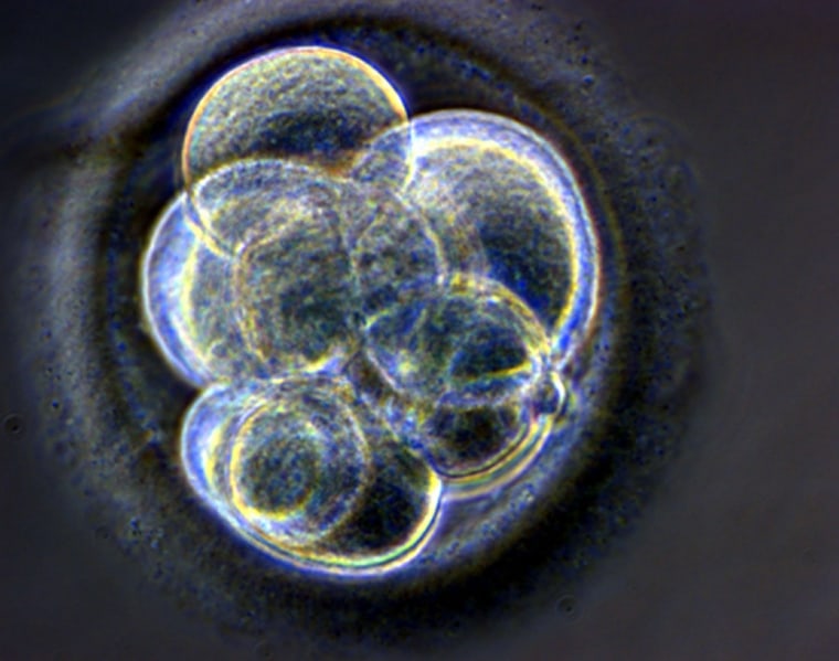 Image: A cloned human embryo
