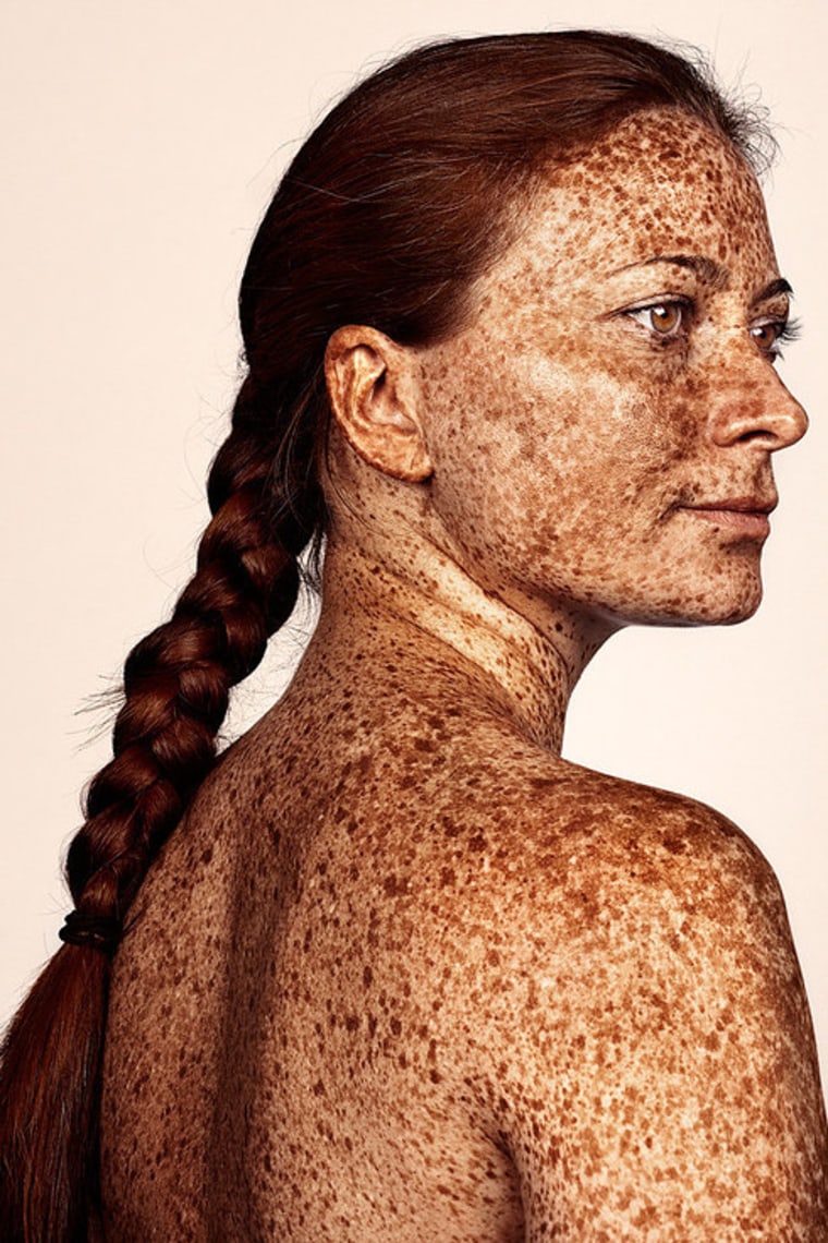 https://media-cldnry.s-nbcnews.com/image/upload/t_fit-760w,f_auto,q_auto:best/newscms/2016_03/942351/freckles-photographer-brock-elbank-today-004-160121.jpg