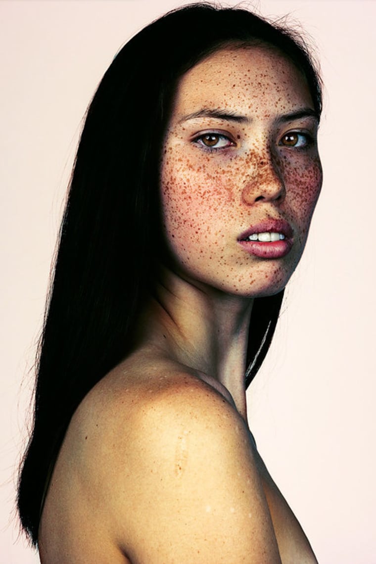 Freckle Photography