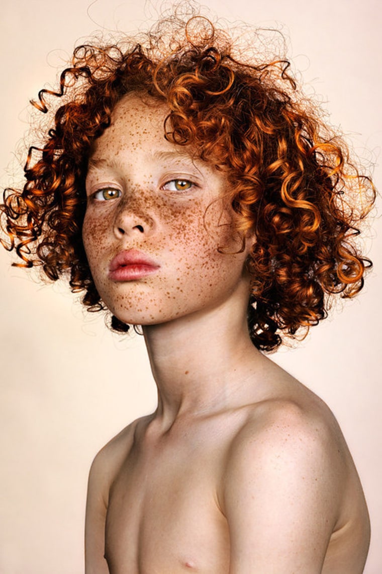 For his #Freckles series, photographer Brock Elbank states he's received hundreds of emails from applicants of "all walks of life and ethnic backgrounds."