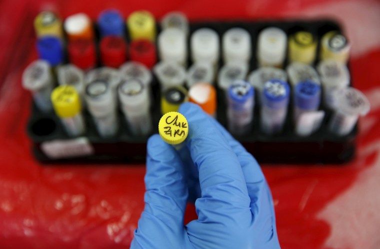 Image: A health technician shows a blood sample from a patient bitten by a mosquito at the National Institute of Health in Lima