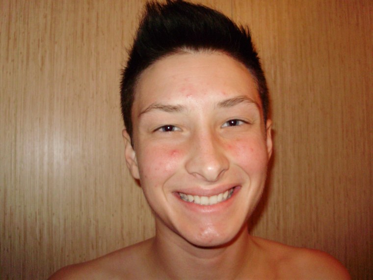 Ashton Colby, age 21, in July 2012, after one month on testosterone.