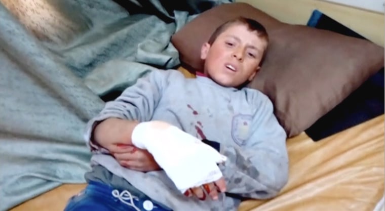 Image: Still image taken from video shows a boy lying on a bed with an injured hand after what is said to be a missile attack on a hospital in Azaz