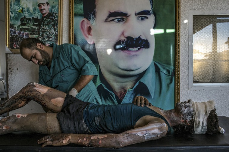 Image: General News, 1st prize singles - Mauricio Lima - IS Fighter Treated at Kurdish Hospital