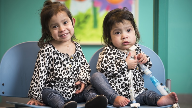 Formerly conjoined twins Knatalye Hope and Adeline Faith Mata visiting Texas Children’s a few weeks before the one year anniversary of their historic separation surgery.