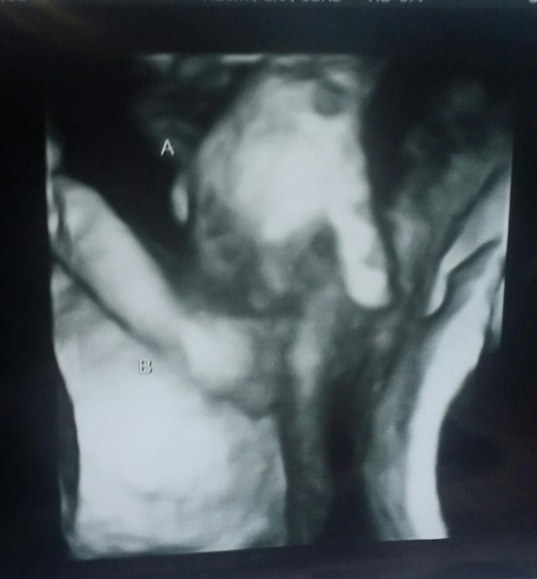 baby holding hands sonogram
