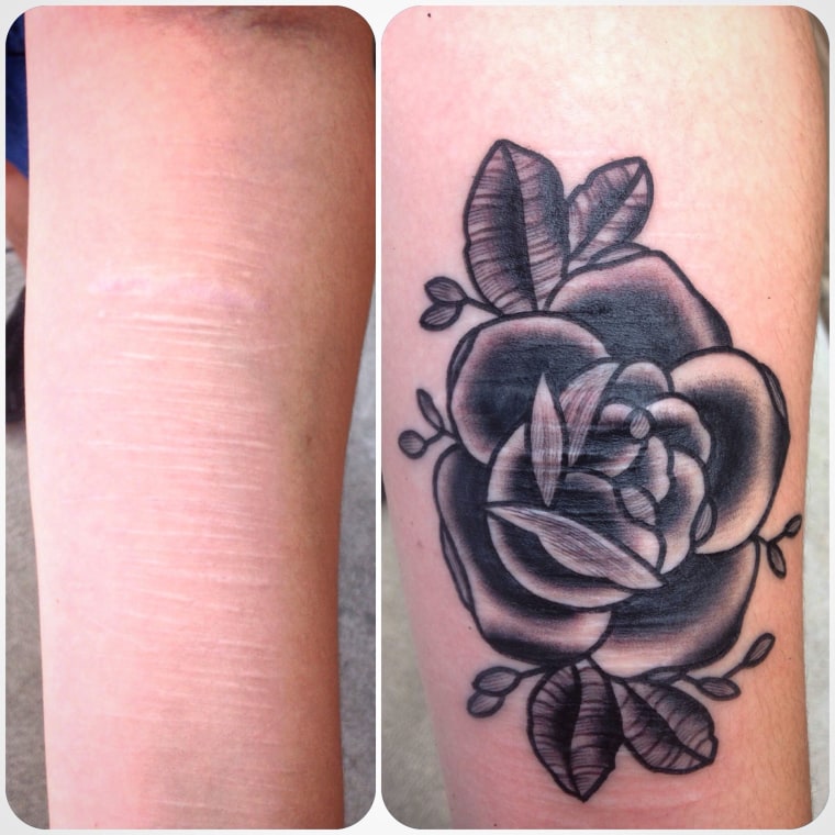 From Scar to Art: The Power of Tattoo Cover-Up, by Anastasiia Koviazina