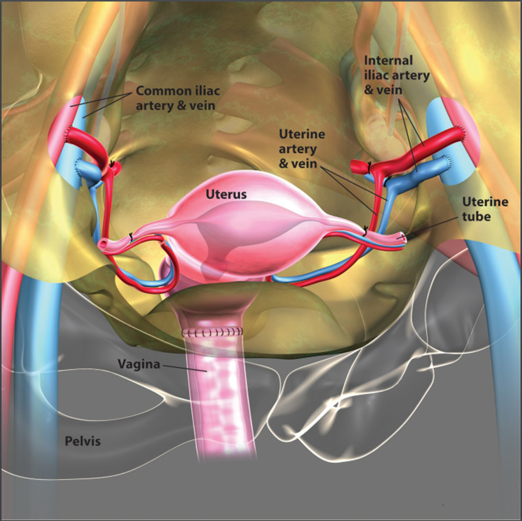 image: Uterus Transplant Illustration
