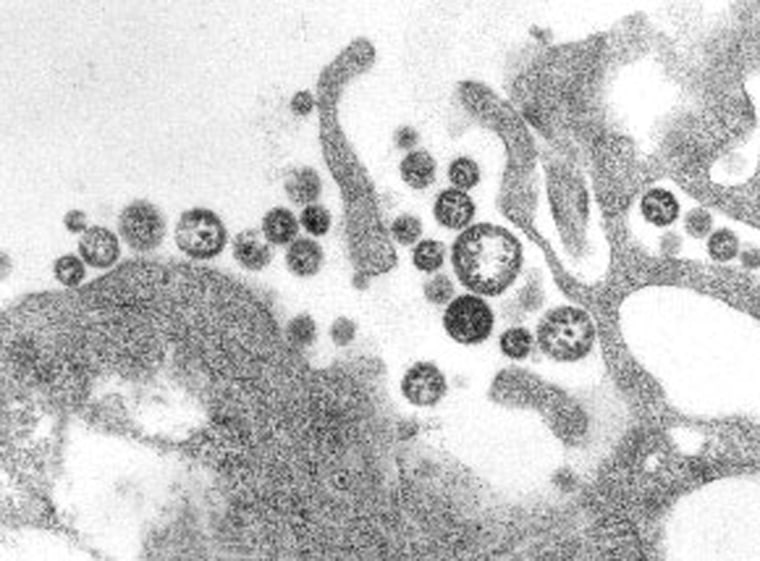 Image: Lassa fever virus
