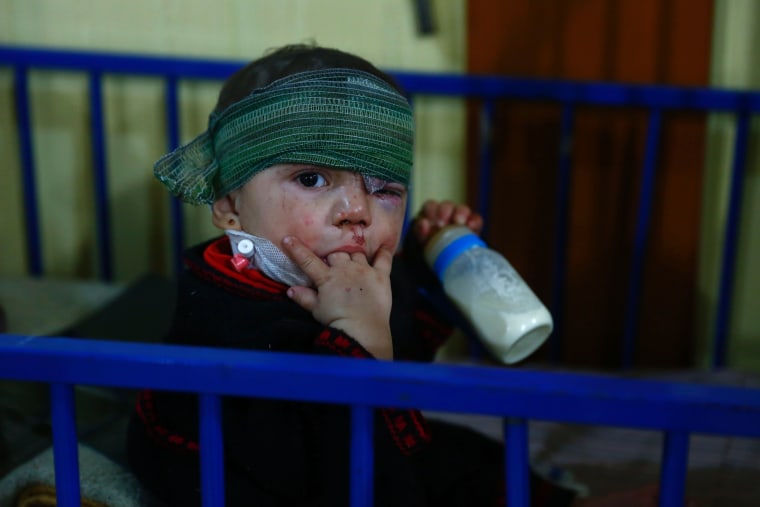 Image: Syrian boy injured by airstrikes in Douma on Feb. 26, 2016