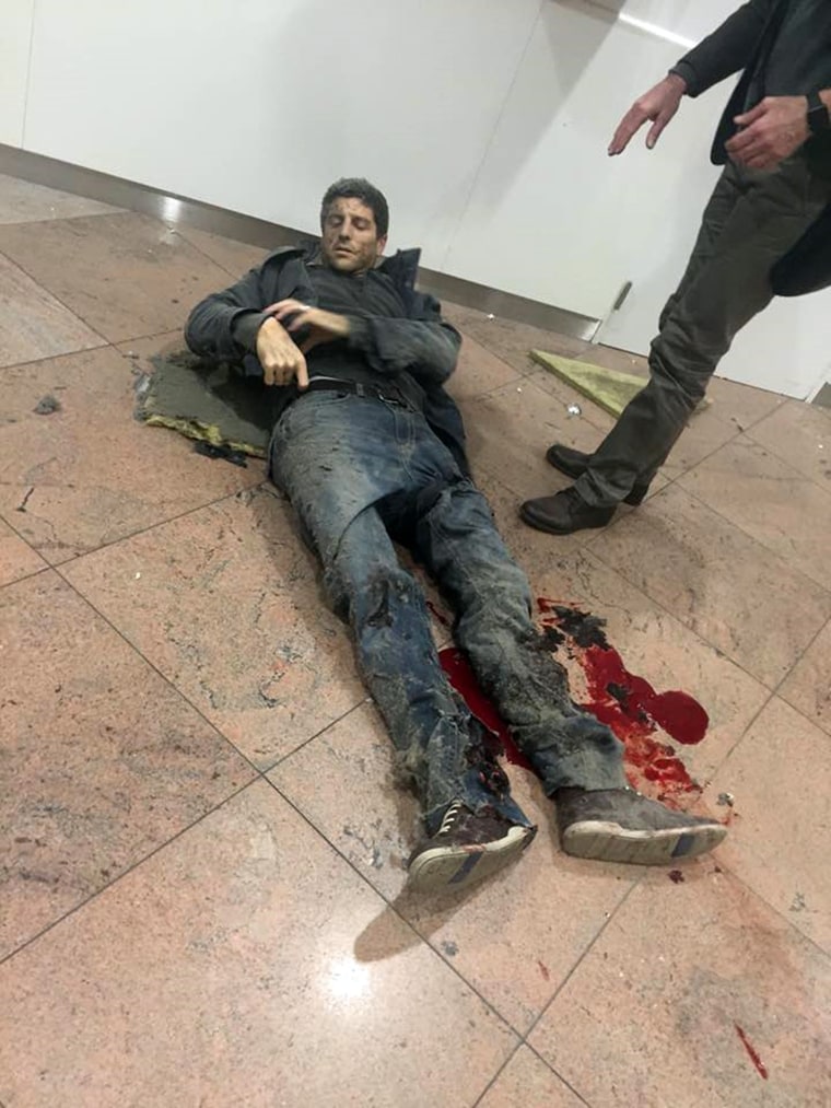 Image: A man is wounded at the Brussels Airport in Brussels