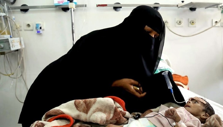 Image: Yemen War Hunger