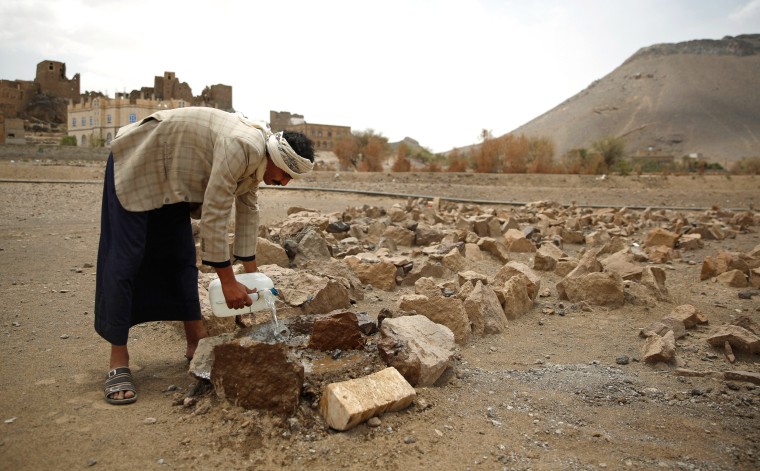 Image: Faisal Ahmed - Yemen War Hunger
