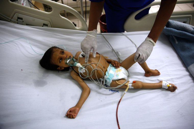 Image: Yemen War Hunger