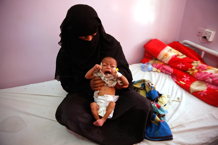 Image: Yemen War Hunger