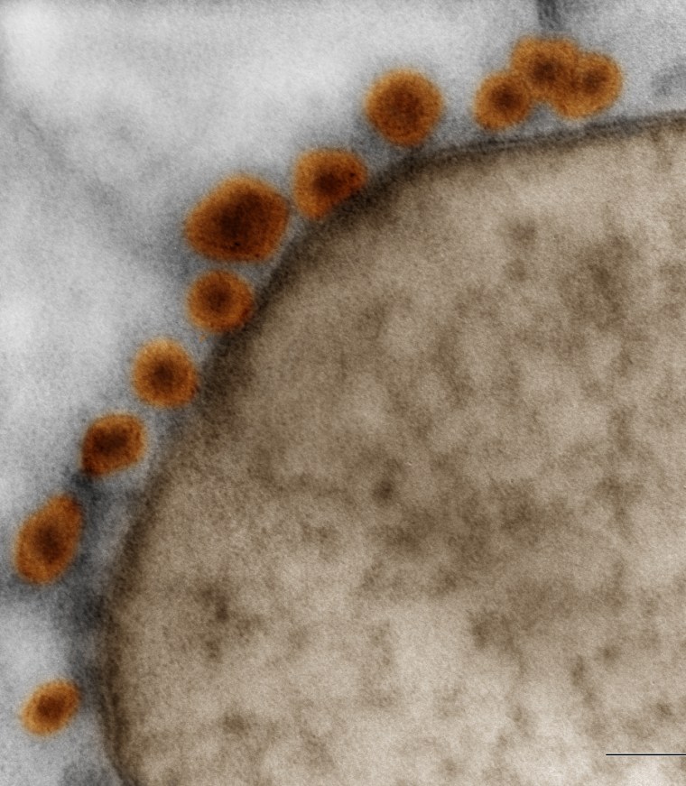 Electron microscopy of Zika virus (orange) bound to cell membrane (brown) in neurosphere generated
from human iPS cells.
