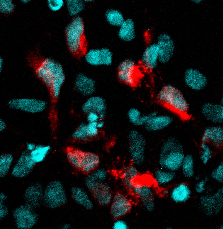 Confocal microscopy of human neural stem cell culture infected with Zika virus (red). Cell nuclei are shown in blue.