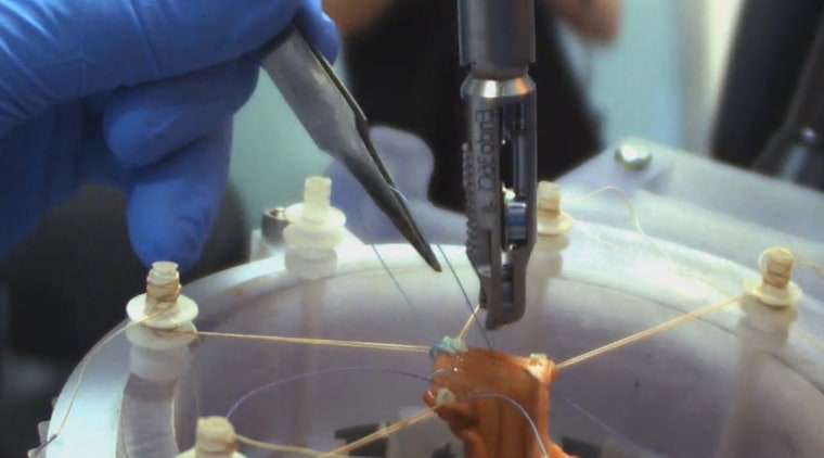 The Smart Tissue Autonomous Robot performs soft tissue surgery on pig intestinal tissue.