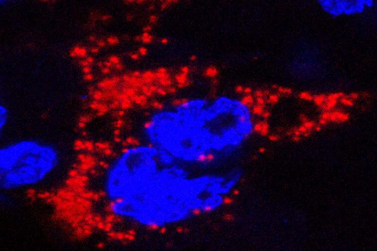  Zika virus, marked with red, infects a mouse placenta. 