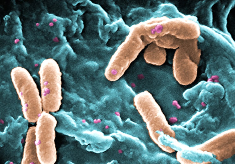 Title: Scanning Electron Micrograph of Pseudomonas aeruginosa  


Photo Credit: CDC/Janice Carr