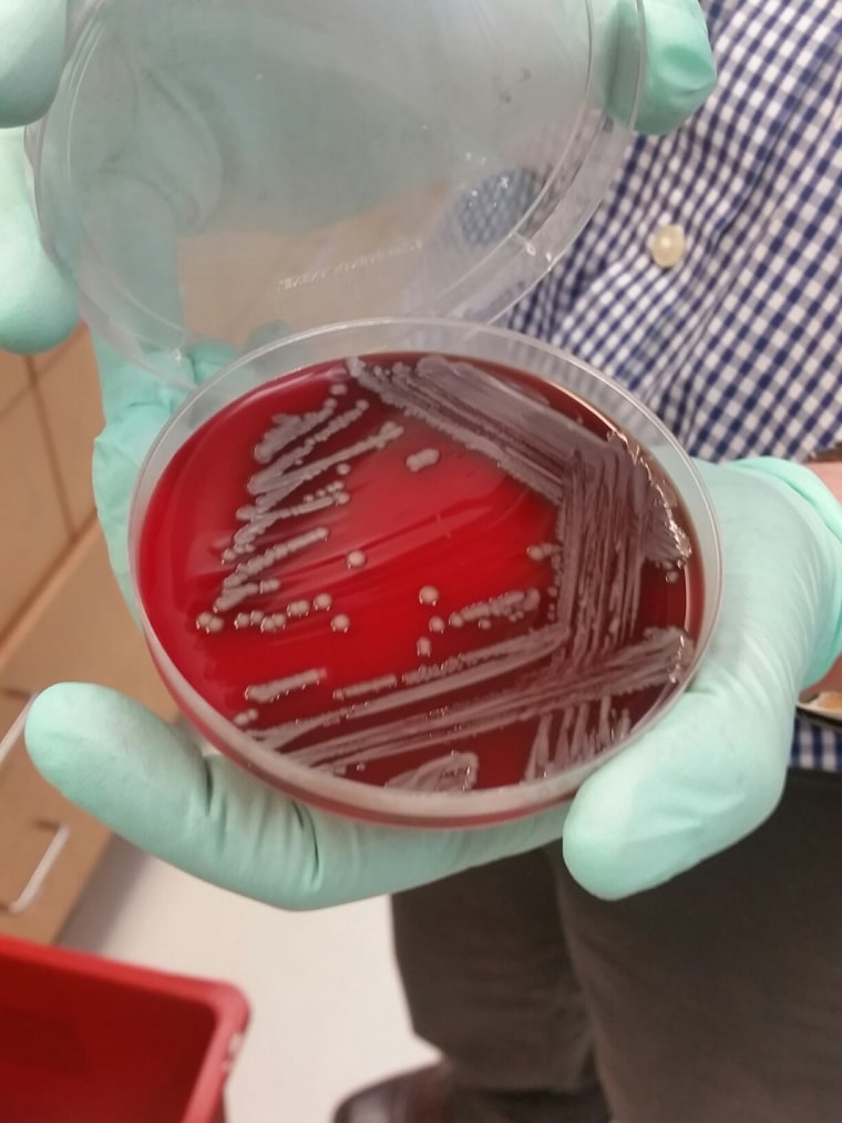 Patrick McGann of the Walter Reed Army Institute of Research displays a culture of multiple drug resistant E coli taken from a Pennsylvania patient.