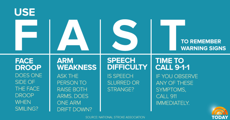 INFOGRAPHIC-stroke symptoms-today-160108