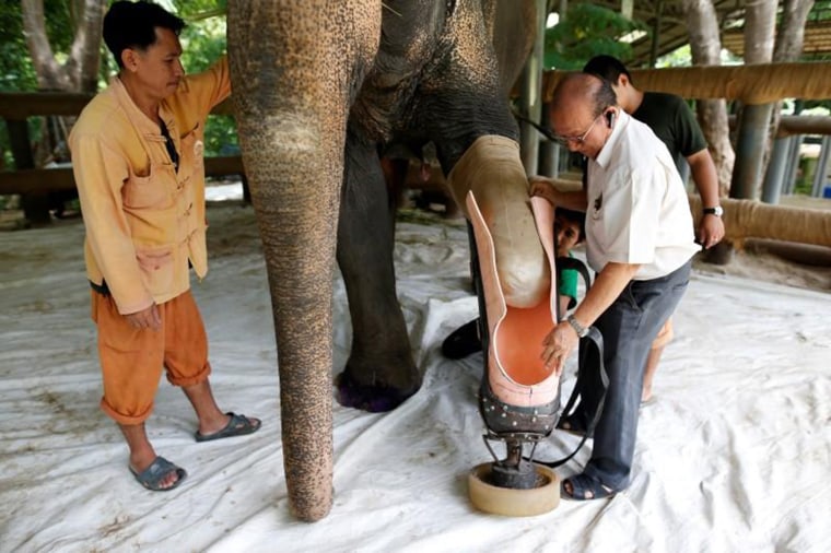 Mosha gets prosthetic leg.