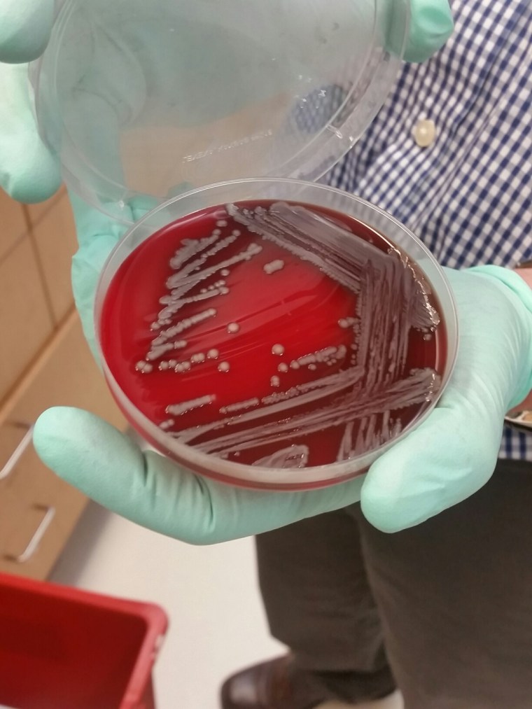 A lab dish with a sample of bacteria carrying the mcr-1 "superbug" gene, found at Walter Reed Army Institute for Research earlier this year. Now researchers have found a second, different, superbug gene on a pig farm.