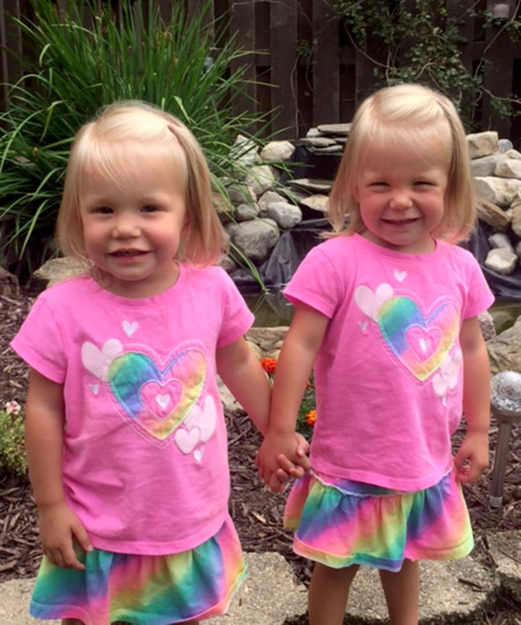 Twins born holding hands are now incredibly close 2-year-olds