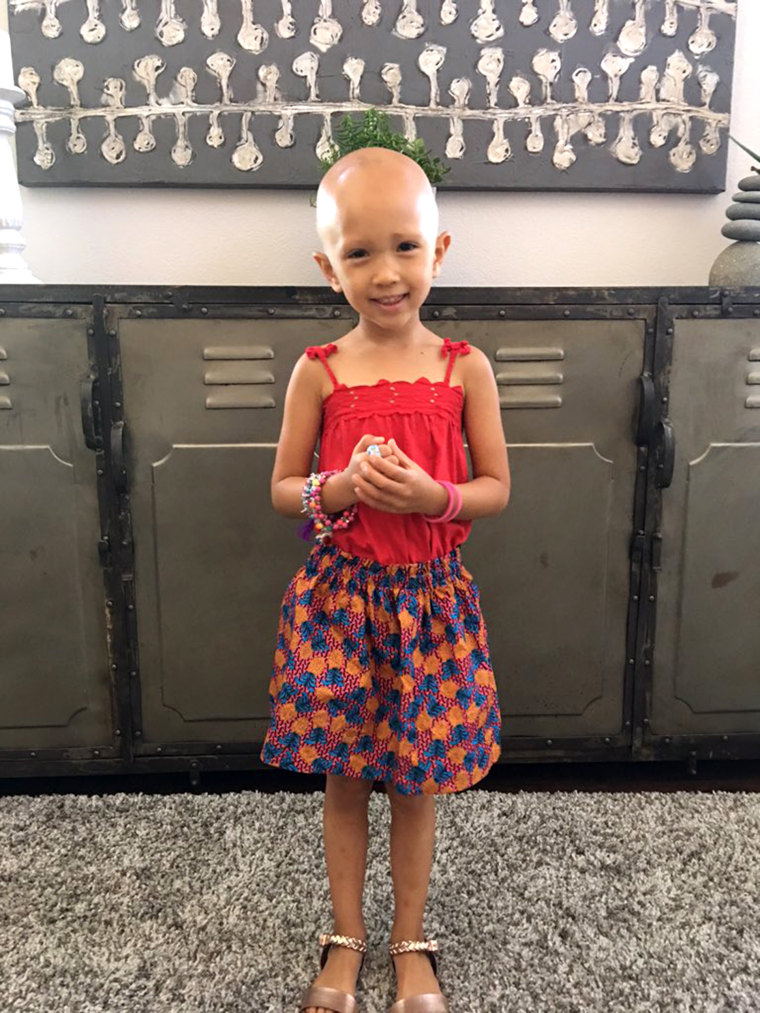 Meet the 4-year-old fashion designer with alopecia who's making trash bags  trendy