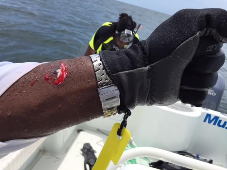 Retired NFL player and Hall of Famer Warren Sapp was bitten by a shark while fishing for lobster off the coast of Florida, July 27.