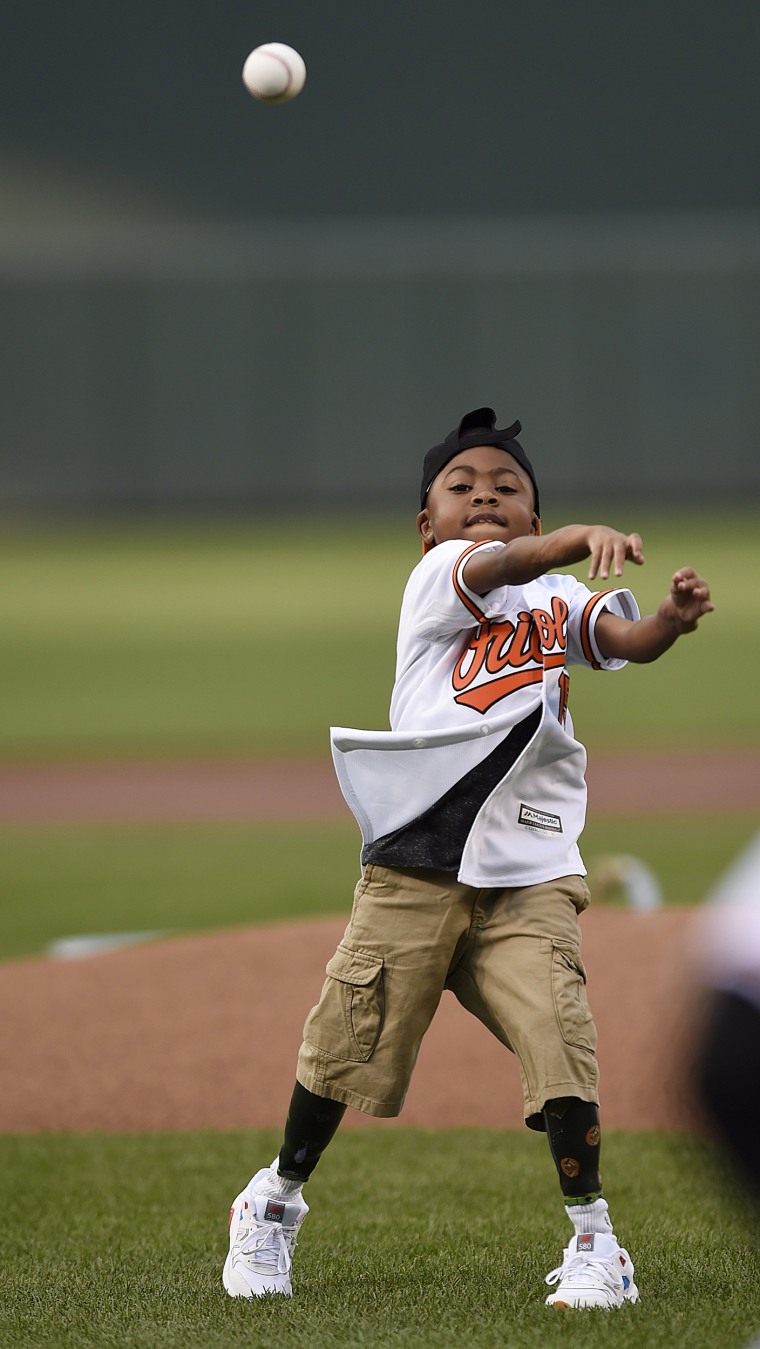 Transplant survivor tosses first pitch at Cardinals game, News